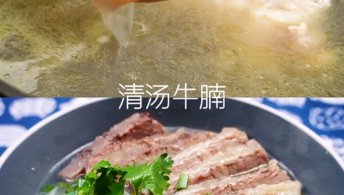 ţ