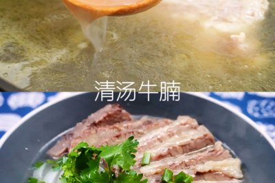 ţ